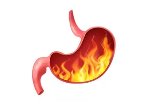 Какие два симптома гастрита вы можете не замечать