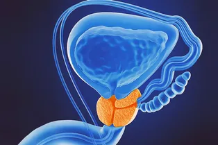 4 опасных признака рака простаты: проверьте себя
