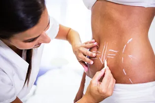 Женщина борется за жизнь из-за осложнений после абдоминопластики