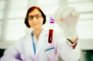 Препараты от холестерина могут нарушать свертываемость крови Препараты от холестерина могут нарушать свертываемость крови