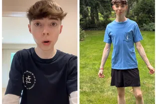 Этому мужчине 35 лет, но он выглядит как ребенок: вот его секрет вечной молодости