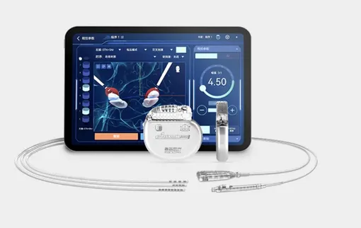 Нейроимпланты от компании SceneRay, вживленные участникам китайского эксперимента