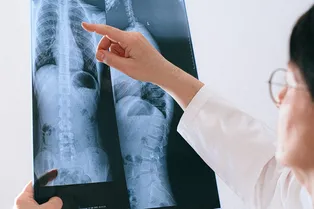 Названа неожиданная причина тяжелого течения коронавируса