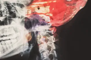 Правда ли, что от пива улучшается память: врачи оценили неожиданный вывод ученых