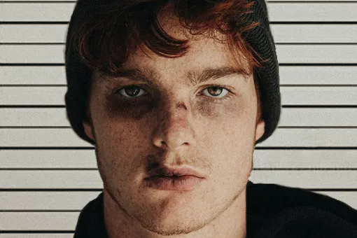 Что такое болевой порог и почему он бывает высоким и низким Что такое болевой порог и почему он бывает высоким и низким