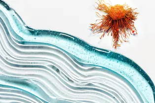 Ученые изобрели гель от рецидивов рака и метастазов после операции