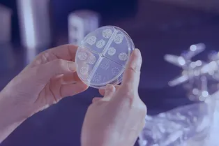 В ВОЗ назвали главную инфекционную болезнь, которая уносит более миллиона жизней в год: что об этом важно знать В ВОЗ назвали главную инфекционную болезнь, которая уносит более миллиона жизней в год: что об этом важно знать