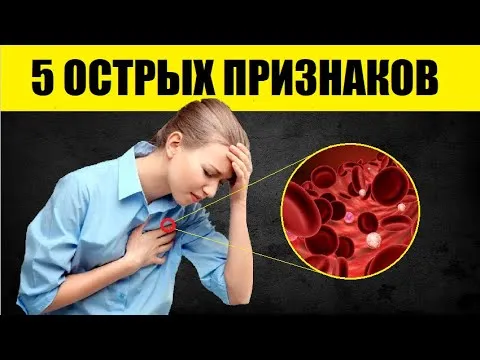 Нажми и смотри