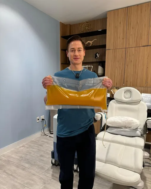 Биохакер Брайан Джонсон перед процедурой плазмотерапии