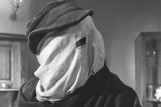 Реальная история «Человека-слона»: жуткие уродства превратили жизнь юноши в кошмар — узнайте, как плохо он кончил