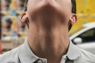 Блогер из Владивостока продал кожу на шее под размещение рекламы