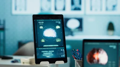 Искусственный интеллект в психотерапии