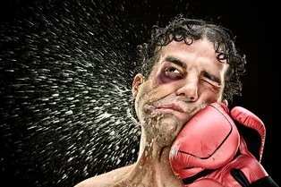 Можно ли убрать синяк под глазом за три дня?