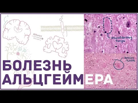 Нажми и смотри
