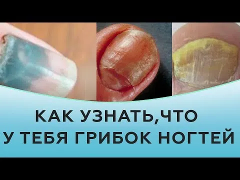 Нажми и смотри